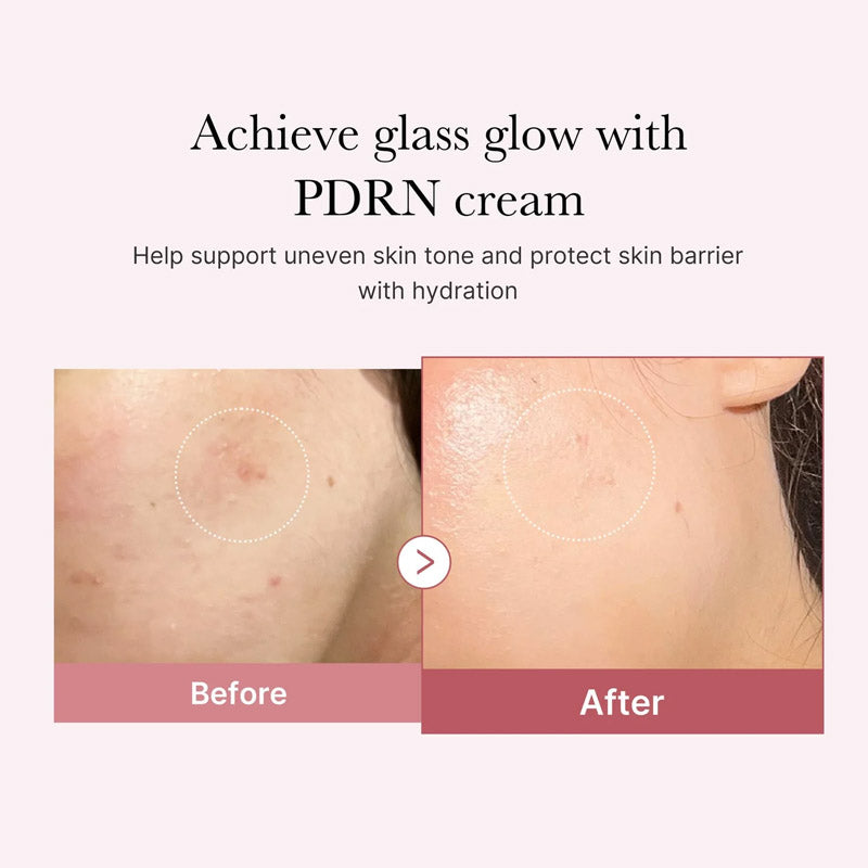 [K-beauty] Medicube PDRN PINK HYALURONIC MOISTURIZING CREAM double Gift Set (50ml+50ml)