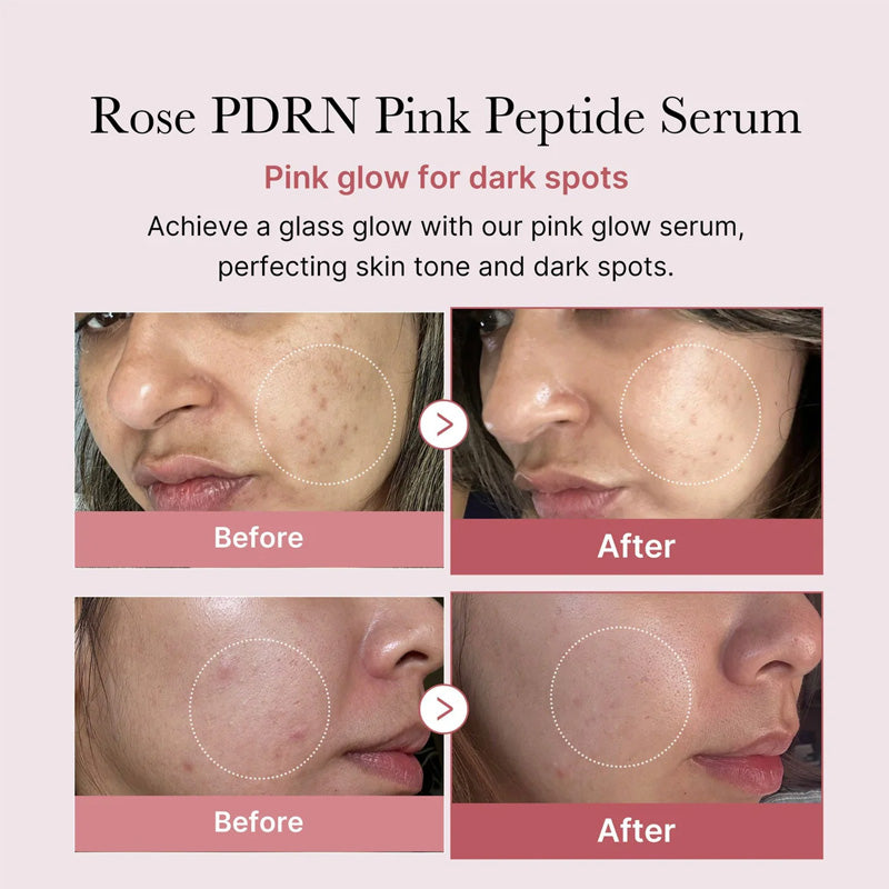 [K-beauty] MEDICUBE PDRN PINK PEPTIDE Serum