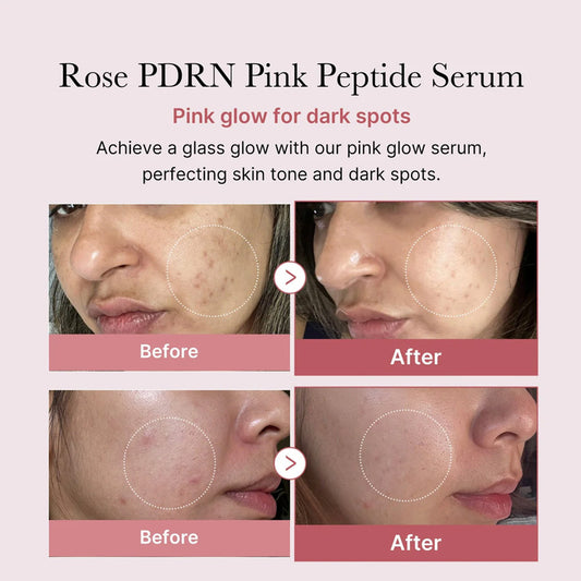 [K-beauty] MEDICUBE PDRN PINK PEPTIDE Serum