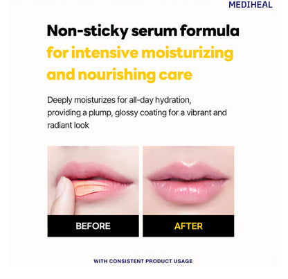 [K-beauty] Mediheal Pantenolips Serum Honey