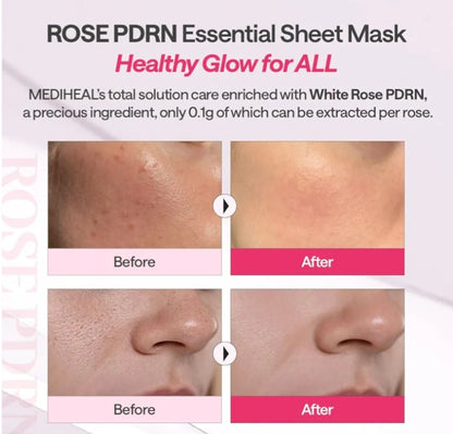 [K-beauty] Medheal Rose PDRN Essential Mask_Revitalizing (10sheets)