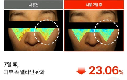 [K-beauty] MEDIPEEL MELANON X Dark Spot GEL 15ml_Dark spot & Blemish care solution