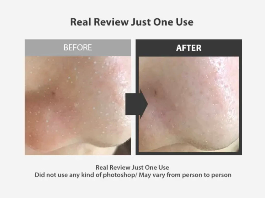 [K-beauty] SUNGBOON EDITOR BLACKHEAD MELTING CLEAR PAD + Serum Control+ Pore Care +Soothing (30 pads)