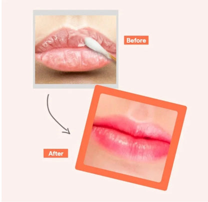 [K-beauty] Medheal Pantenolips Healssence Coral