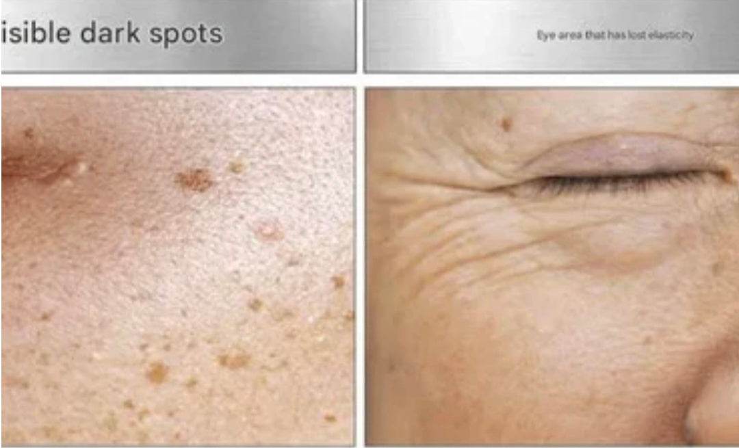 [K-beauty] MEDIPEEL MELANON X Dark Spot EYE CREAM 20ml_Dark spot & Blemish care solution