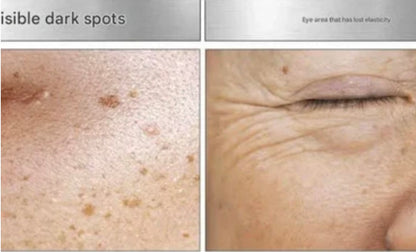 [K-beauty] MEDIPEEL MELANON X Dark Spot EYE CREAM 20ml_Dark spot & Blemish care solution